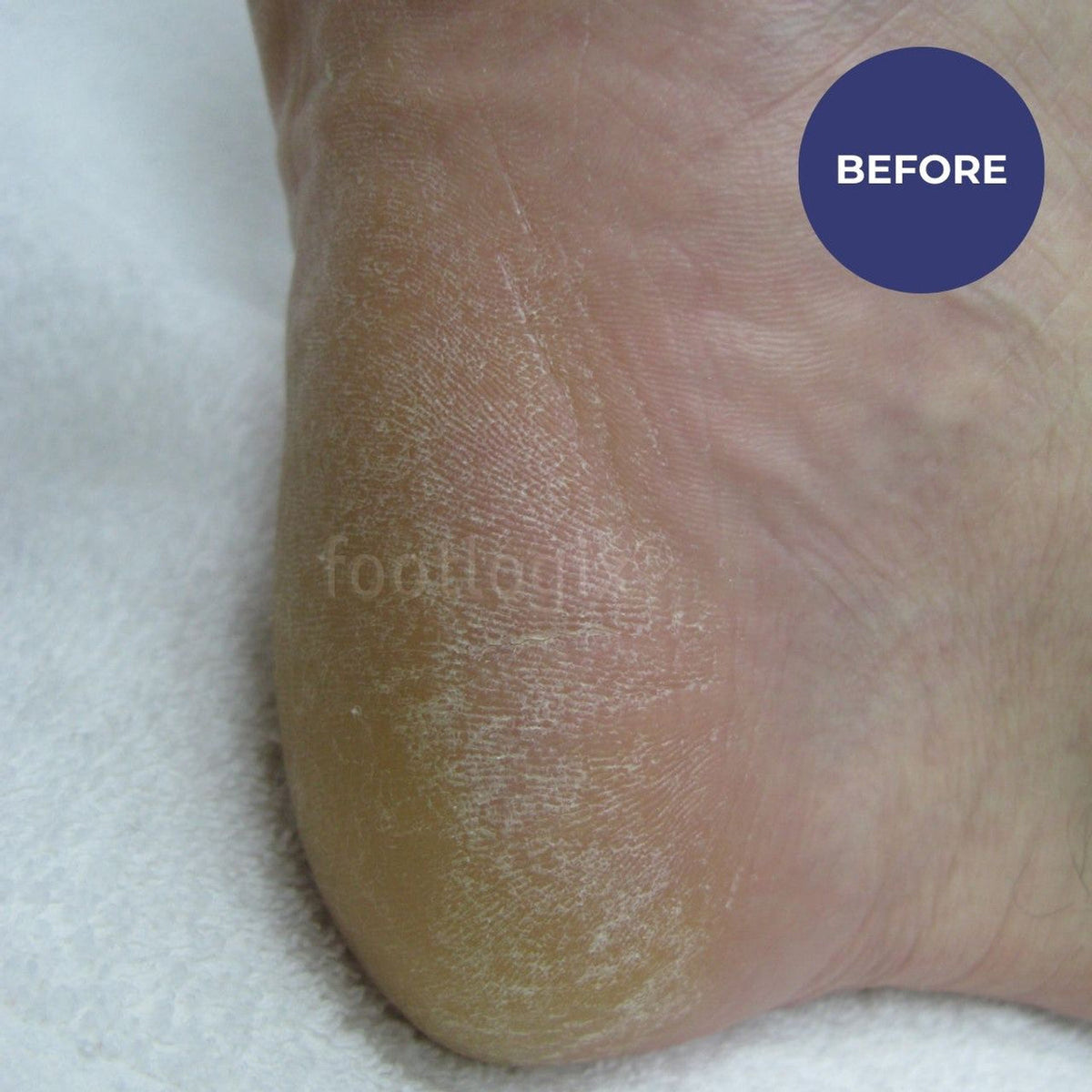 Footlogix Daily Maintenance Formula 125ml