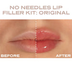 Plump It! - At Home Clinic Box
