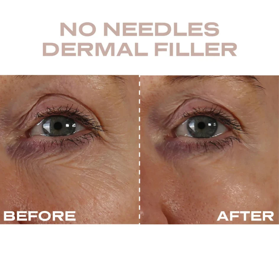 Plump It No Needles Derma Filler Pods Starter Kit 15 x 10ml