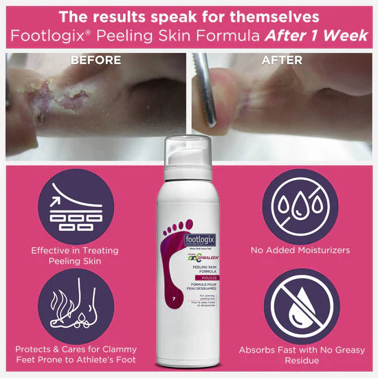 Footlogix Peeling Skin Formula 125ml