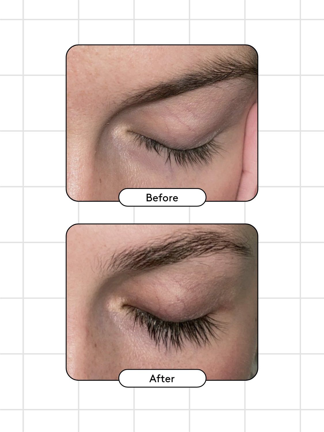 Xlash Eyelash Serum 3ml Best Naturally Eyelash Serum for Longer Eyelashes