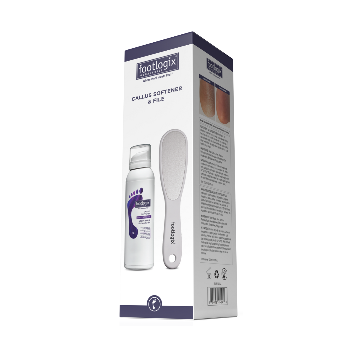 Footlogix Ultimate "At Home" Foot Care Combo 100ml