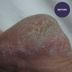 Footlogix DD Cream Mousse Formula 125ml