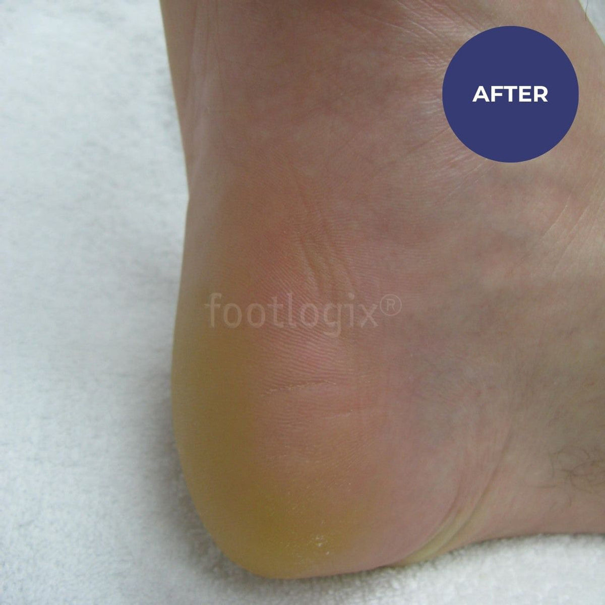 Footlogix Daily Maintenance Formula 125ml
