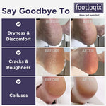 Footlogix Double-Sided Foot File Rubberized Handle - Coarse/Fine