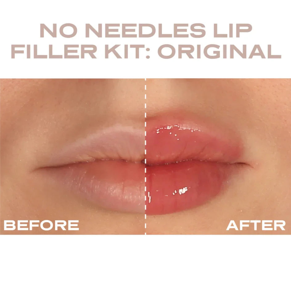 Plump It! - At Home Clinic Box