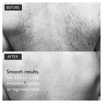 Back & Body Men’s Hair Removal - The Silverback Kit