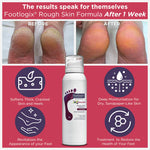 Footlogix Rough Skin Formula 125ml