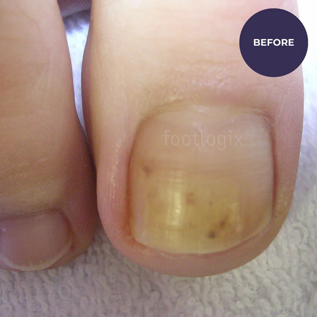Footlogix Toe Nail Tincture 50ml